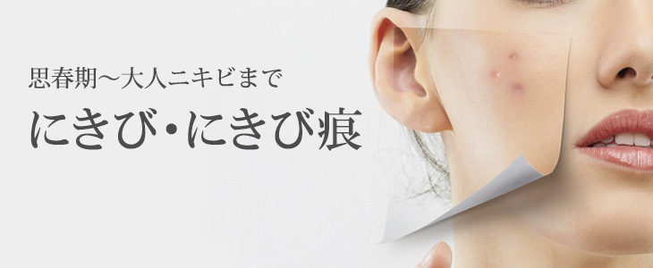 にきび・にきび痕治療