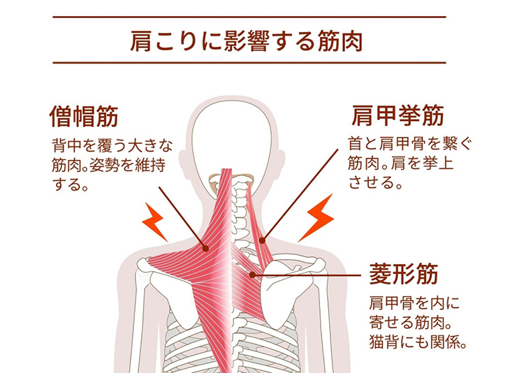 肩ボトックス注射