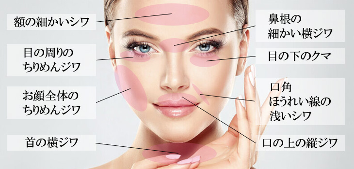 ベビーコラーゲン(ヒューマラジェン)適応部位