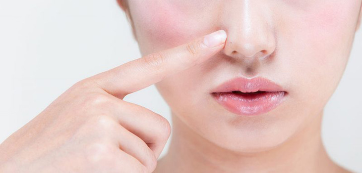 あなたの毛穴はどのタイプ？毛穴タイプ診断と美容皮膚科でできる治療