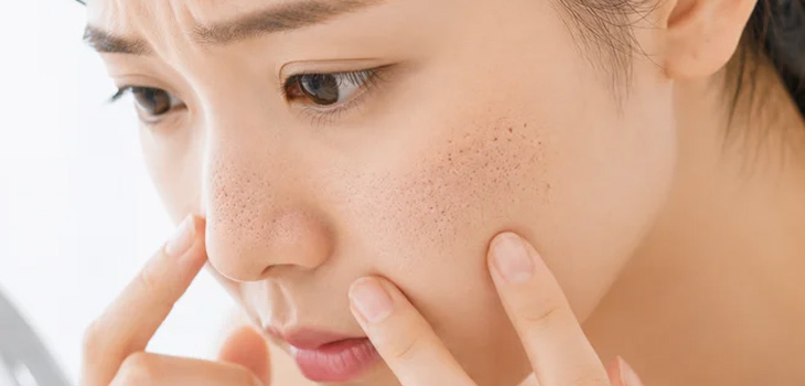 「何をしても毛穴が改善しない」と感じたら