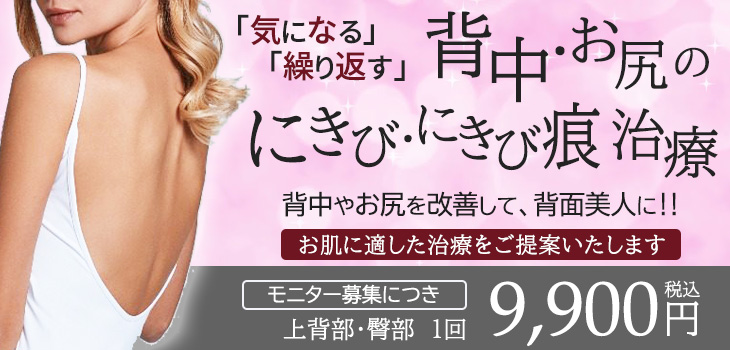 背中のにきびケア キャンペーン
