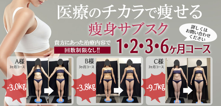 痩身　サブスク　キャンペーン