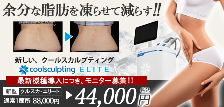 クールスカルプティング　エリート　キャンペーン