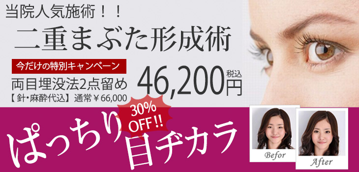 まぶたの二重術　キャンペーン