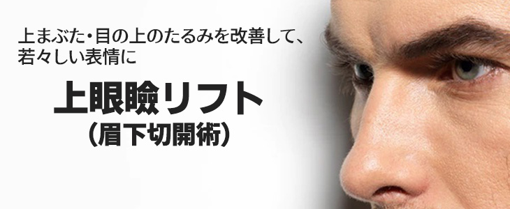 上眼瞼リフト術