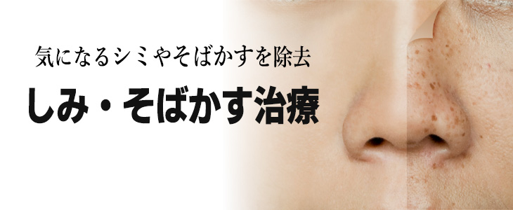 気になるシミやソバカスを除去 しみ・そばかす治療