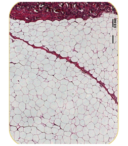 アポトーシスと貧食のプロセス