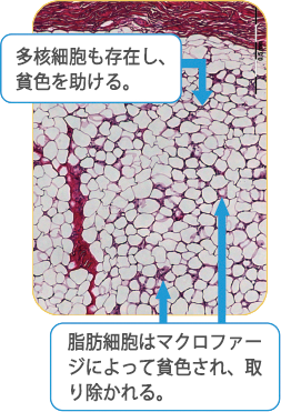 アポトーシスと貧食のプロセス