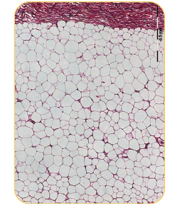 アポトーシスと貧食のプロセスジ