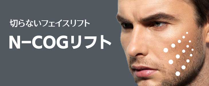 N-COGスパイラルリフト