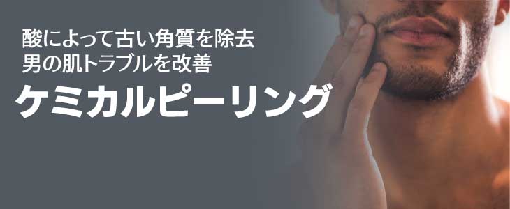 ケミカルピーリング