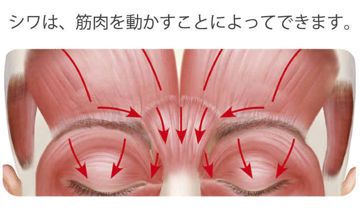 シワは筋肉を動かすことによってできます