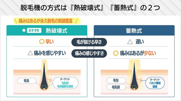 熱破壊式レーザーと蓄熱式レーザーの違い