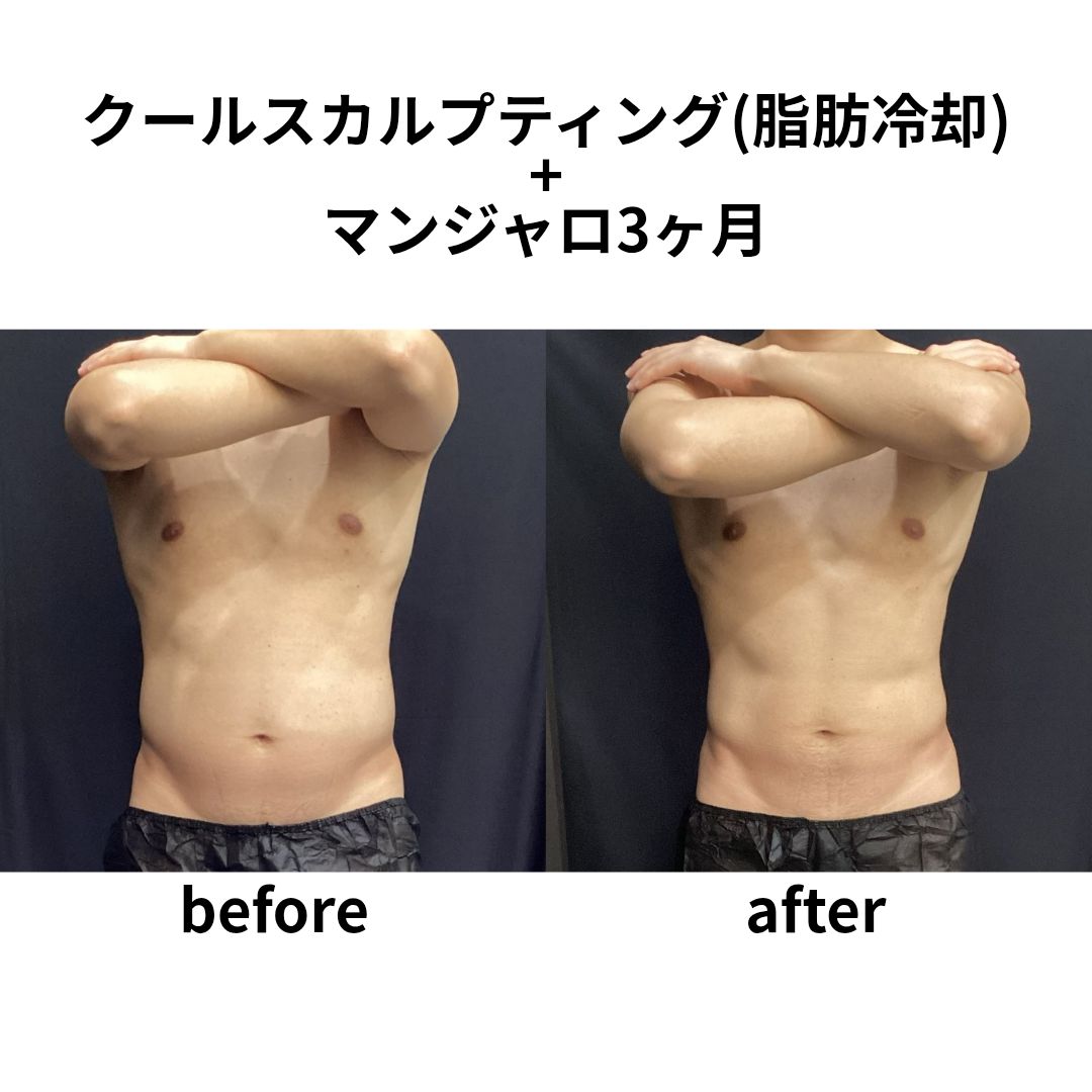 クルスカ+マンジャロ ダイエット