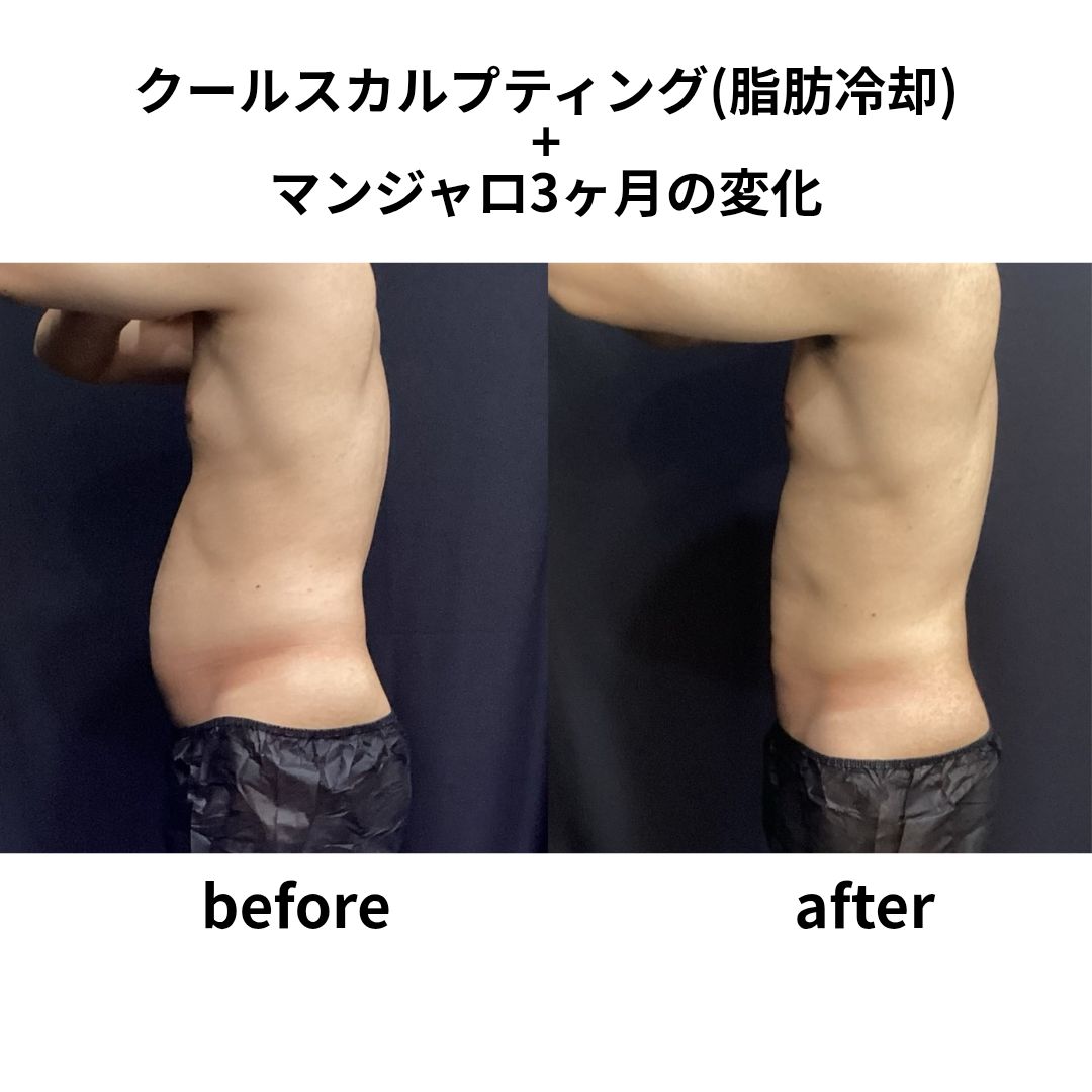 クルスカ+マンジャロ ダイエット