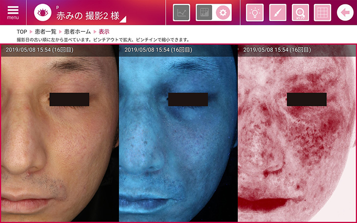 re-beau（レビュー）で肌診断