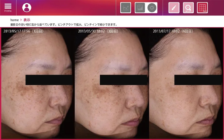 re-beau（レビュー）で肌診断