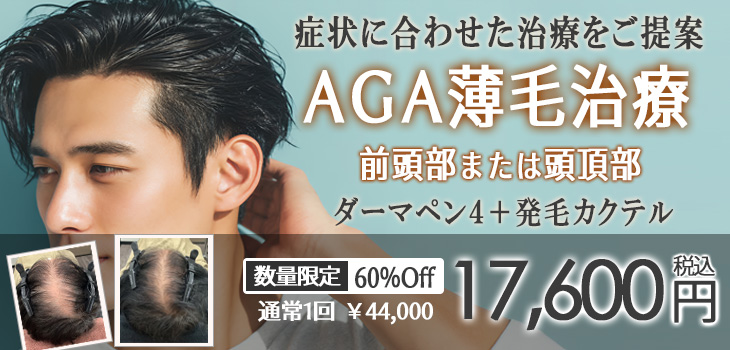 AGA薄毛治療キャンペーン