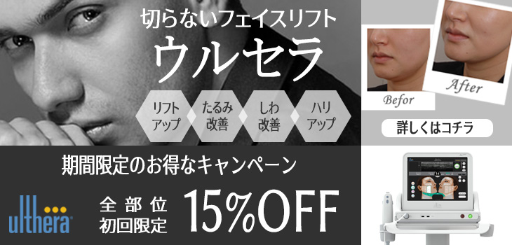 ウルセラ　キャンペーン