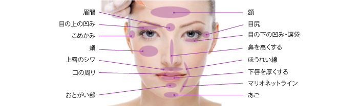 ヒアルロン酸注入 神戸ゆりクリニック